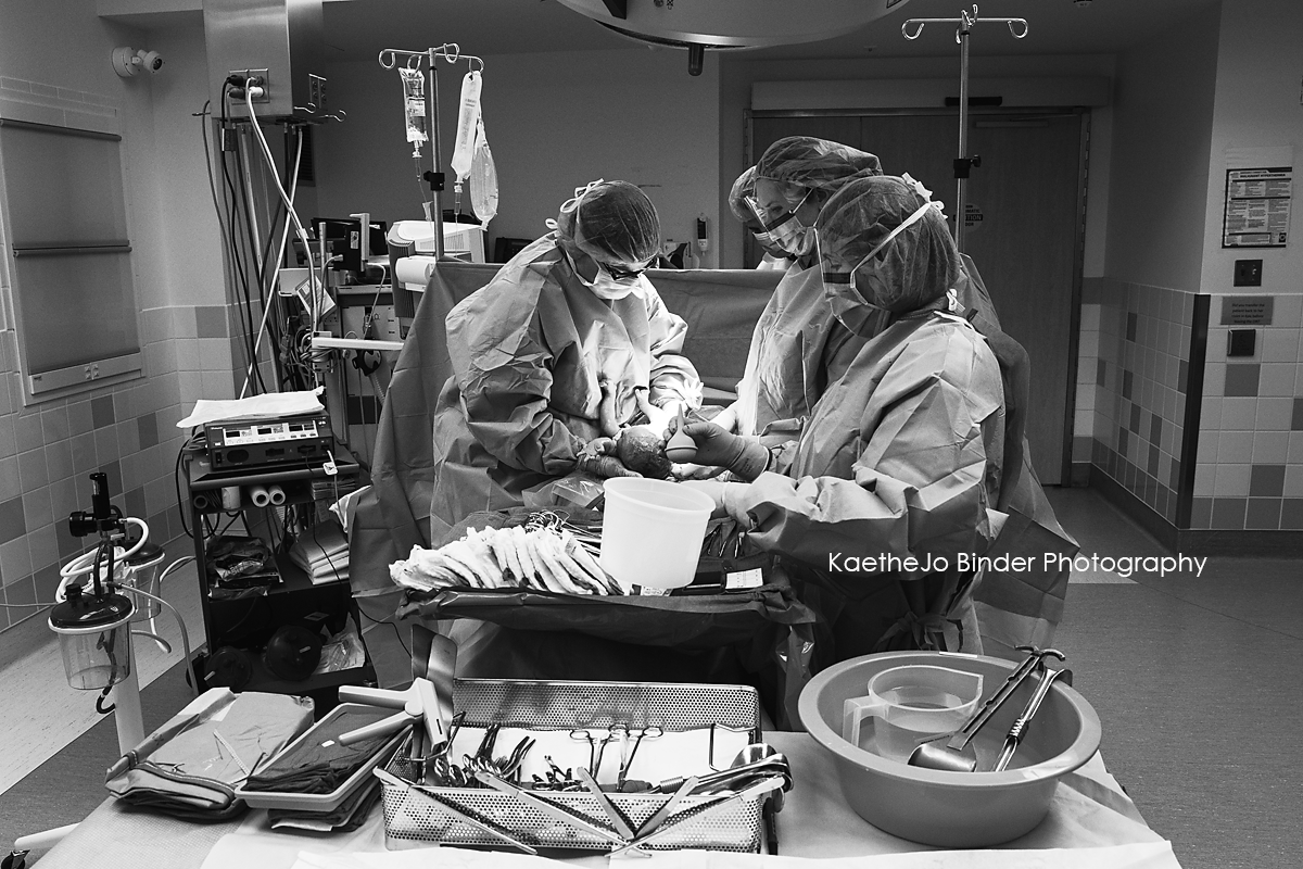 C-Section Delivery by the Tacoma Birth Photographer
